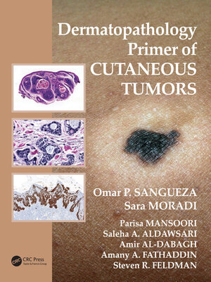 cover image of Dermatopathology Primer of Cutaneous Tumors